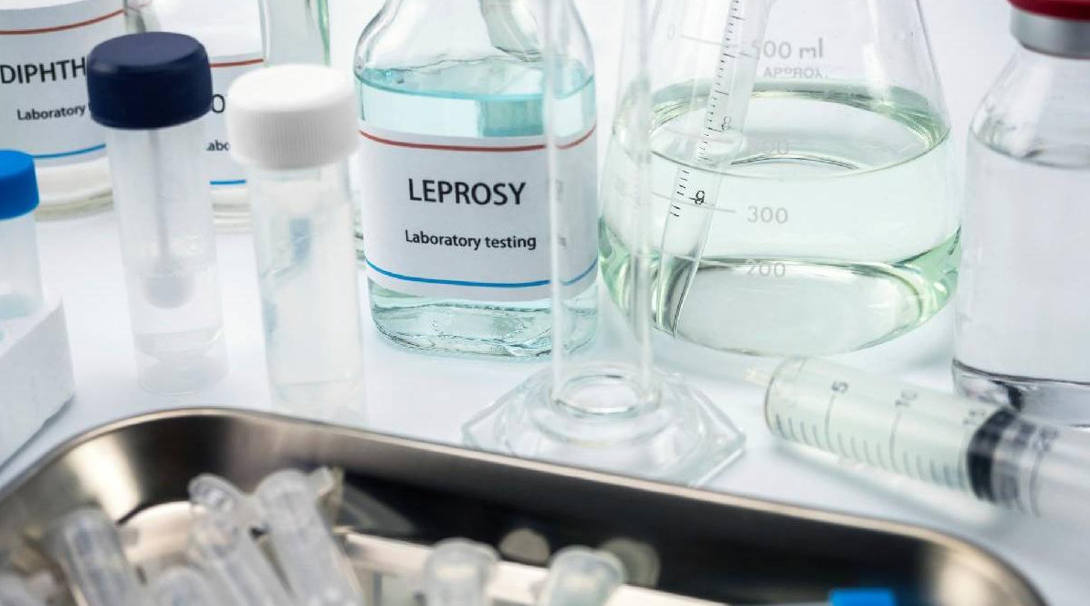 Alerta medicala! Lepra revine in Romania: Semne, simptome si ce trebuie sa stie romanii