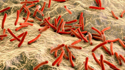 Alerta medicala! Primul caz de...