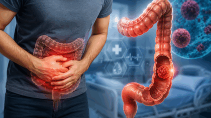 Cancerul de colon a devenit...